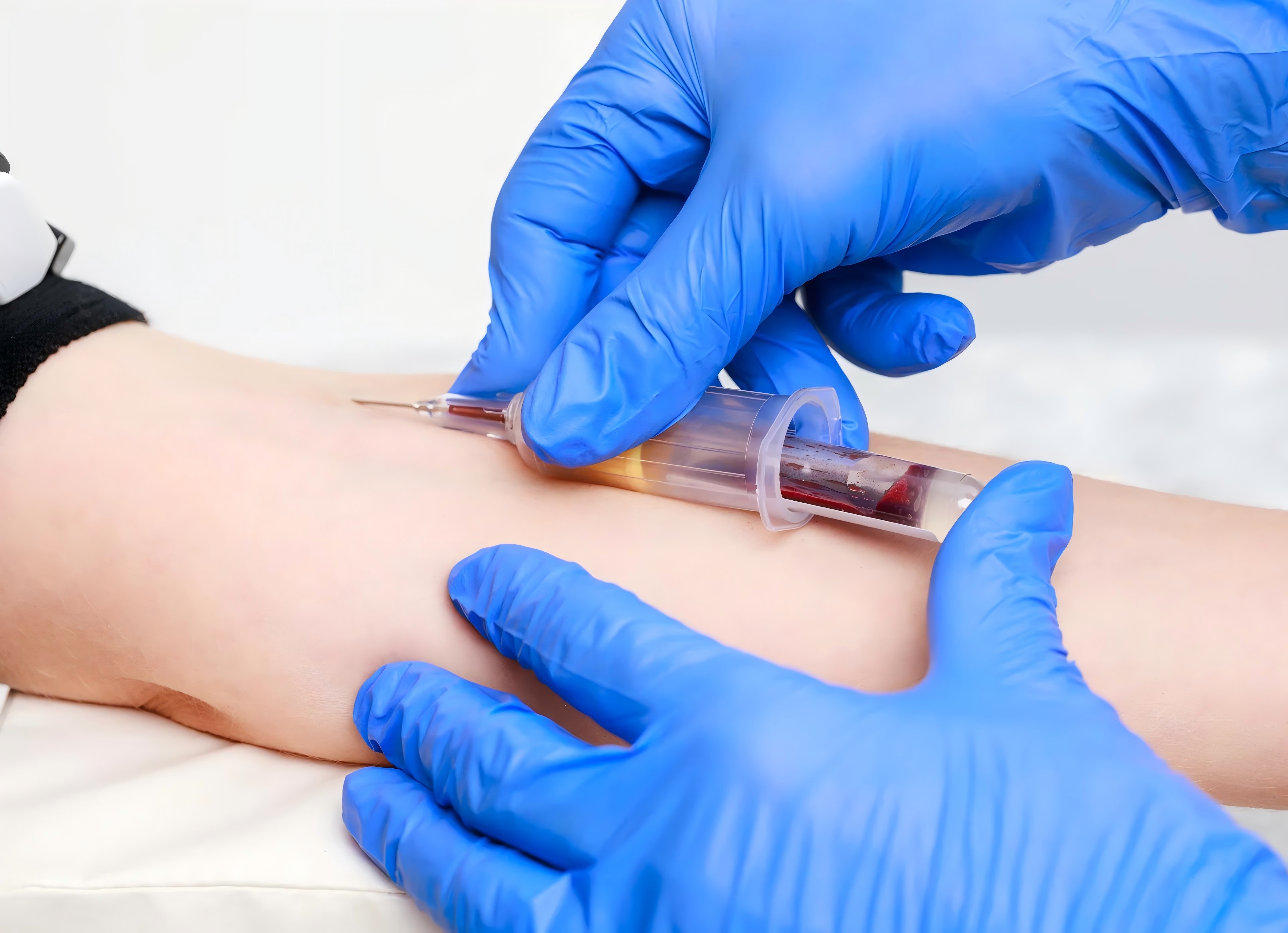 método-más-común-para-extraer-sangre-venosa-presentado