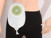 Bolsa drenable médica desechable, bolsa de urostomía de una pieza para ostomía
