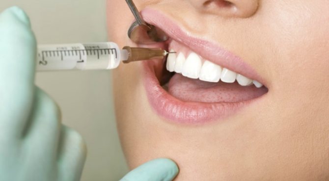 inyecci&oacute;n dental