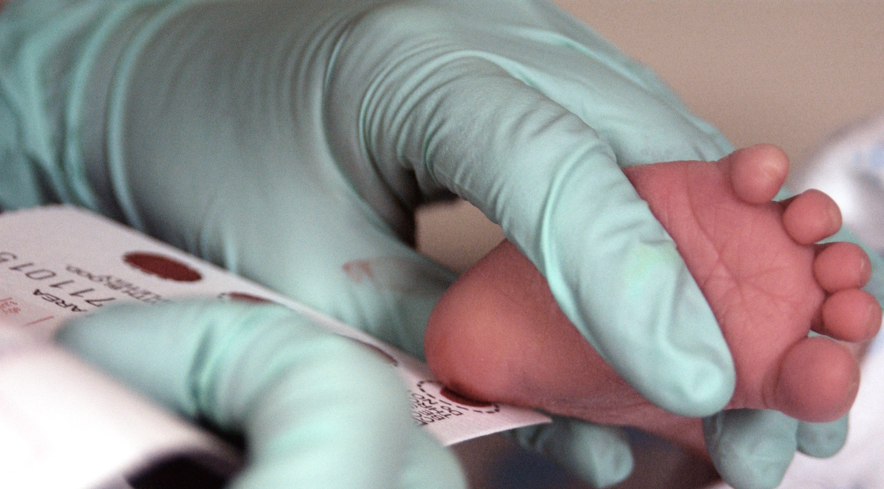 Lanceta para sangre del tal&oacute;n
