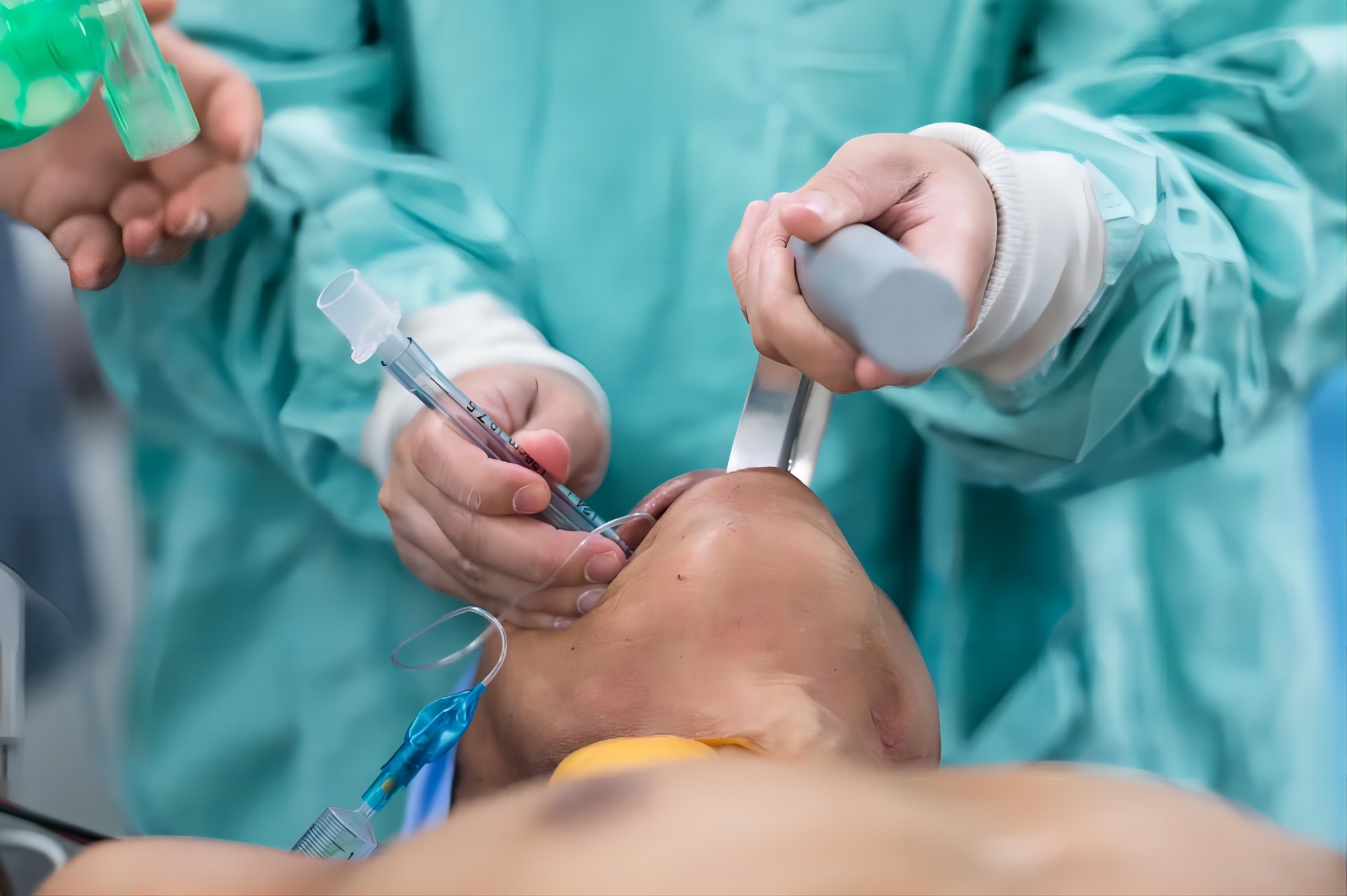 tubo endotraqueal desechable