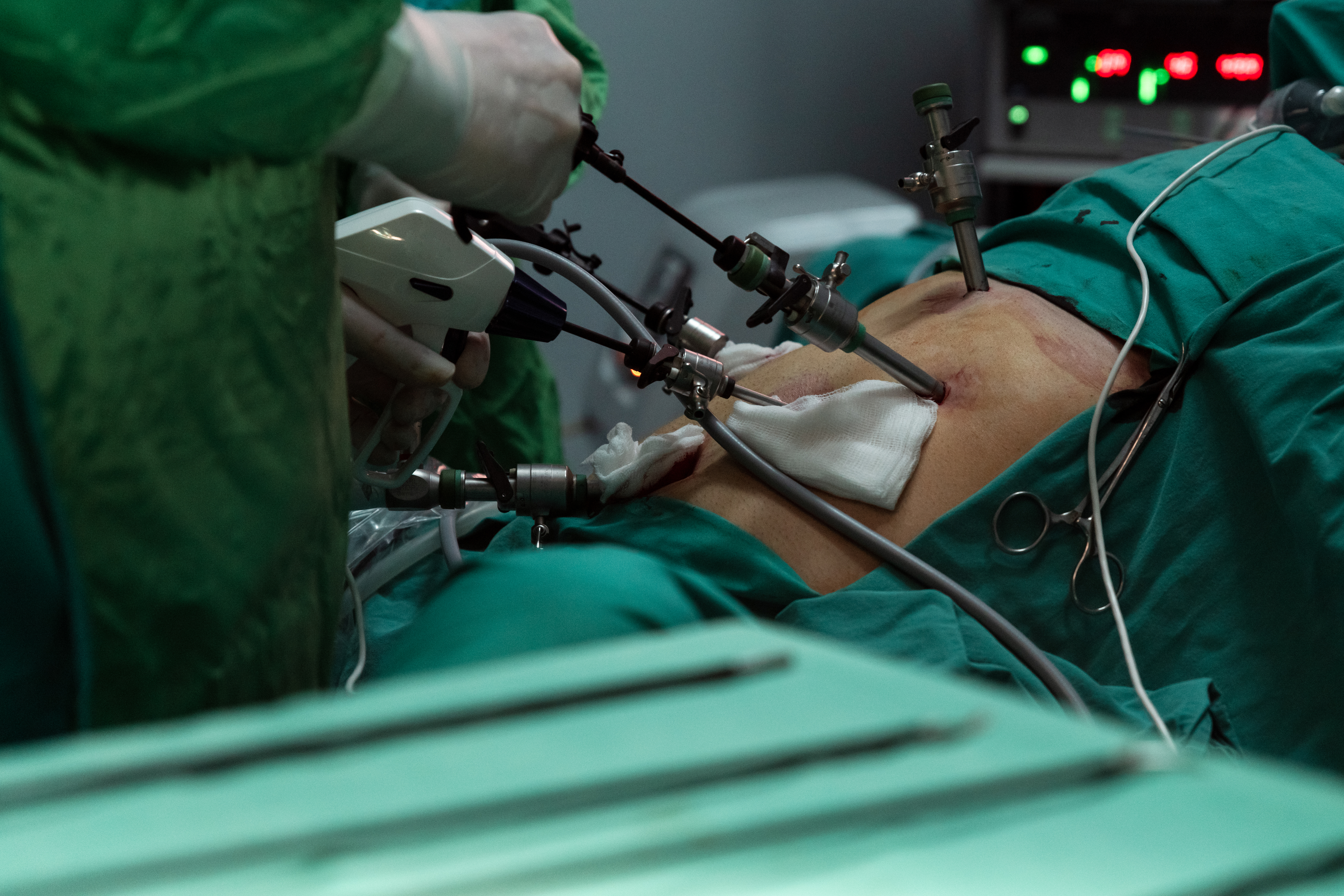 Pack Pelviscopia Laparoscopia