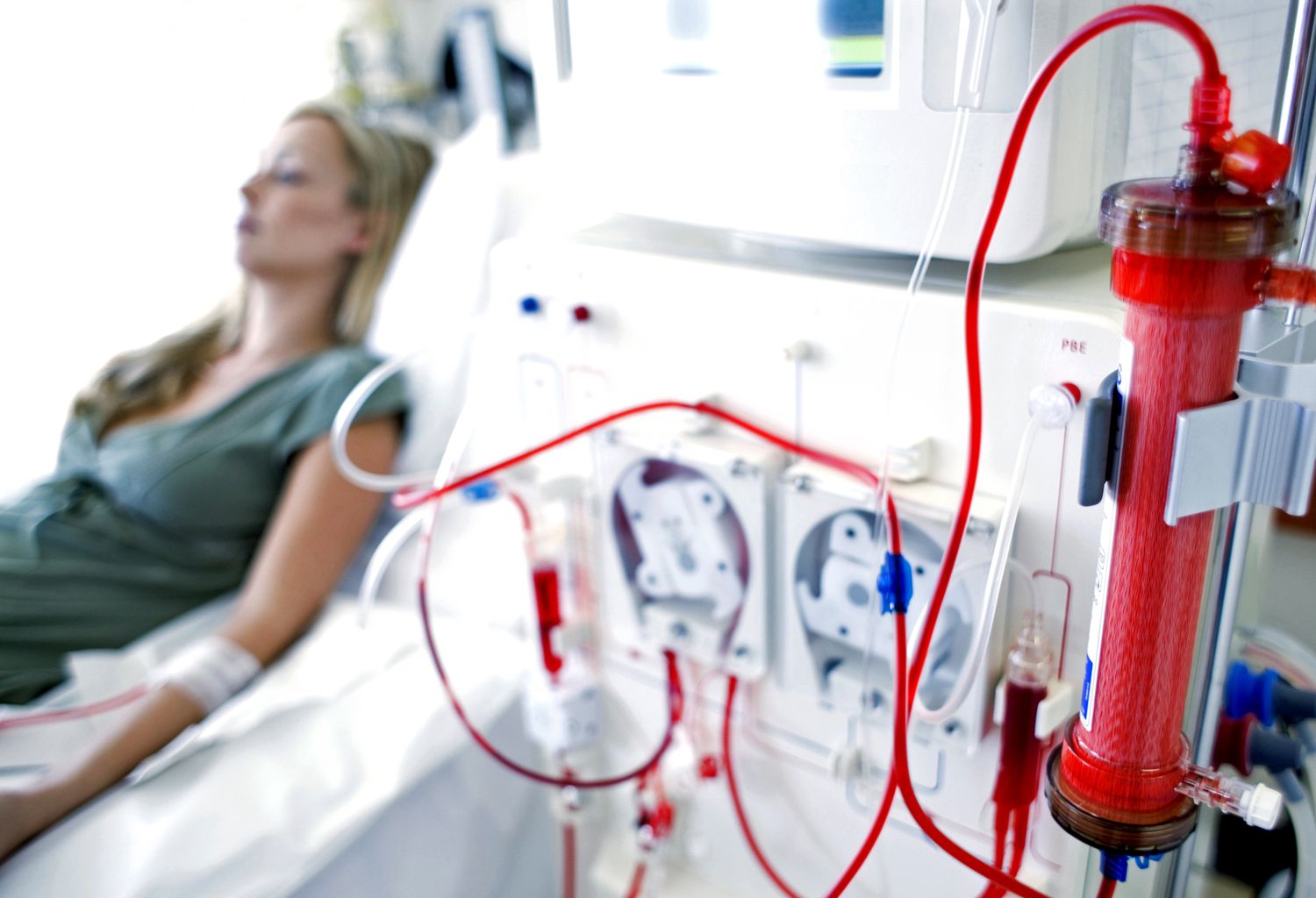 DI&Aacute;LISIS_RENAL-56a275235f9b58b7d0cac1e2