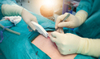 Instrumento quirúrgico médico grapadora de piel desechable para sutura de heridas