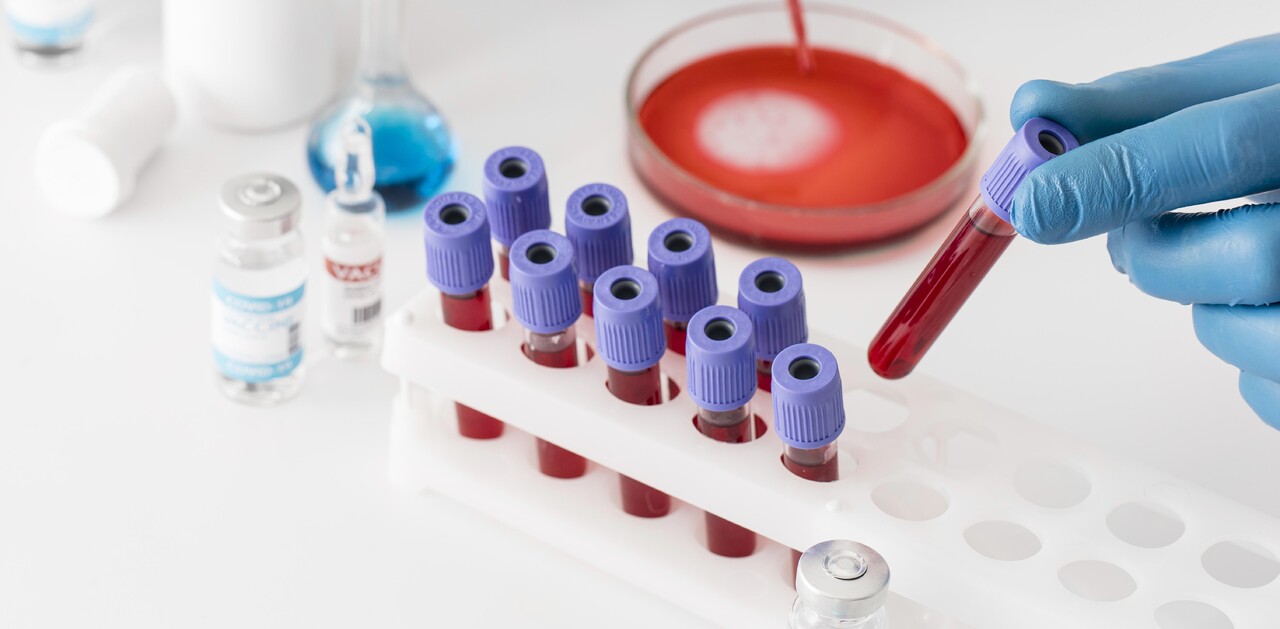 Tubo de extracci&oacute;n de sangre al vac&iacute;o desechable