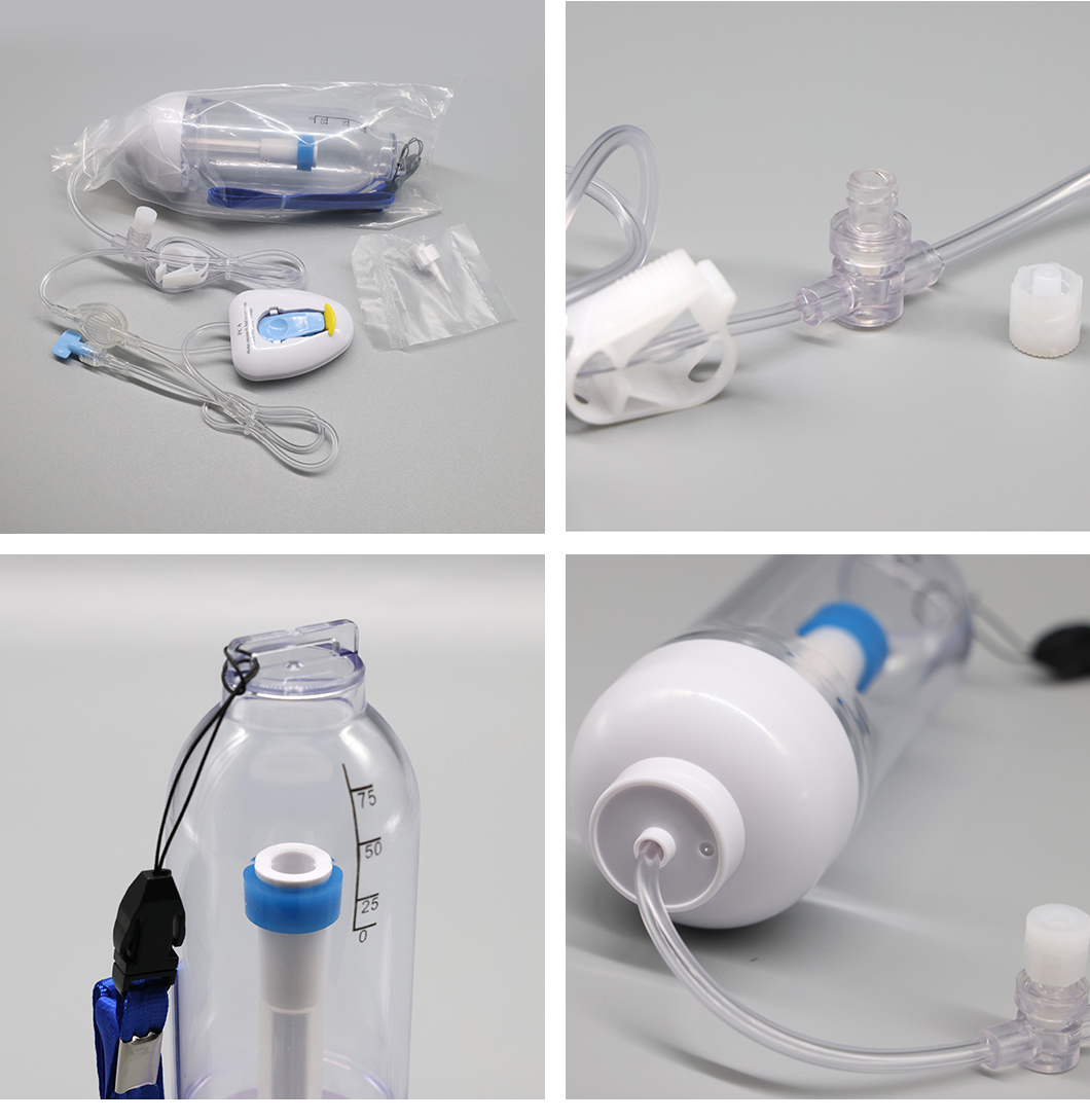 Bomba de infusión elastomérica médica CBI+PCA de tarifa única desechable
