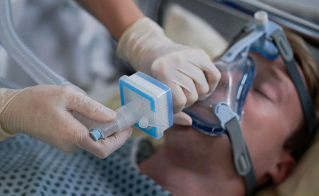 Anesthesia Breathing Filter Tender.jpg