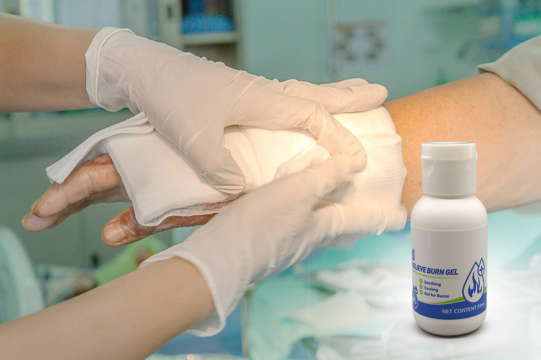 Kit de primeros auxilios de rescate de emergencia, vendaje para quemaduras, cuidado de quemaduras, 59ml, Gel para aliviar quemaduras